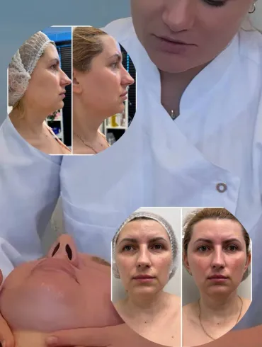 Facial Treatment,  Defined facial contour,  Facial contour lifting