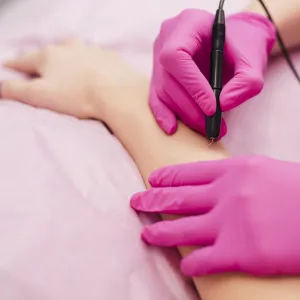 Safe and effective permanent hair removal